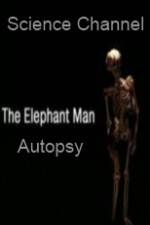Watch Science Channel Elephant Man Autopsy Myflixer