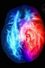 Watch Brain on Fire Myflixer