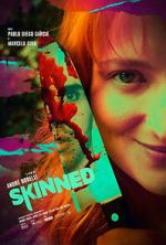 Watch Skinned Myflixer