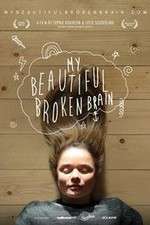 Watch My Beautiful Broken Brain Myflixer